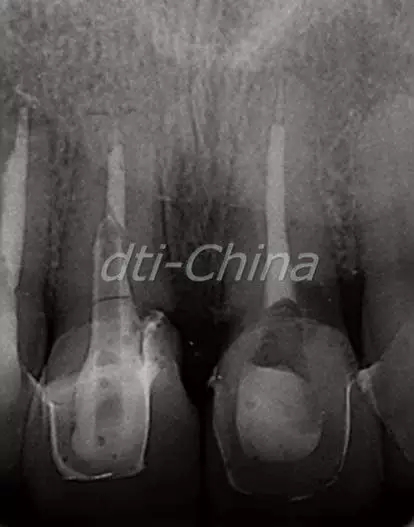 640.webp (4).jpg 640.webp (4).jpg