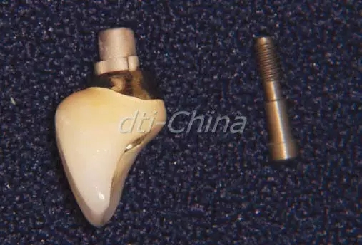 640.webp (6).jpg 640.webp (6).jpg