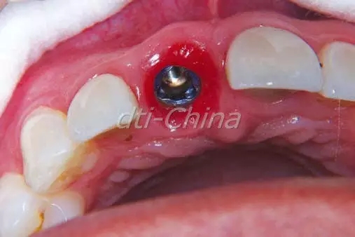 640.webp (7).jpg 640.webp (7).jpg