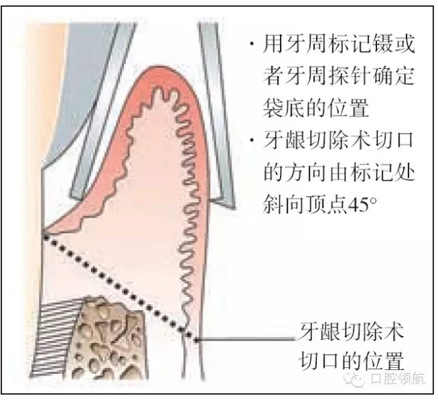 640.webp (50).jpg 640.webp (50).jpg