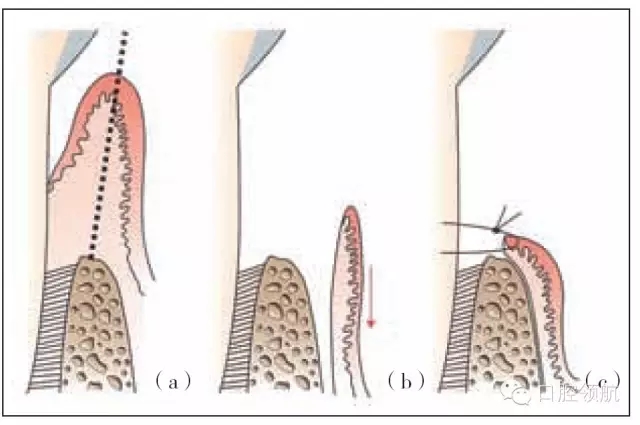 640.webp (51).jpg 640.webp (51).jpg