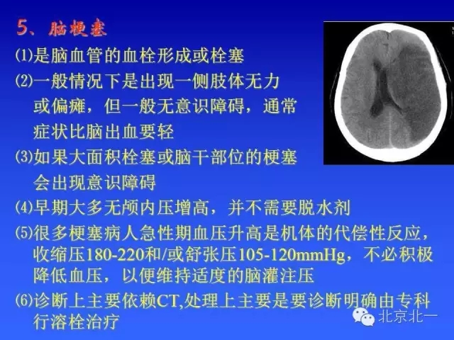 640.webp (11).jpg 640.webp (11).jpg