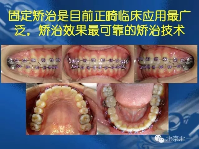 640.webp (1).jpg 640.webp (1).jpg