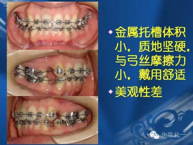 640.webp (4).jpg 640.webp (4).jpg