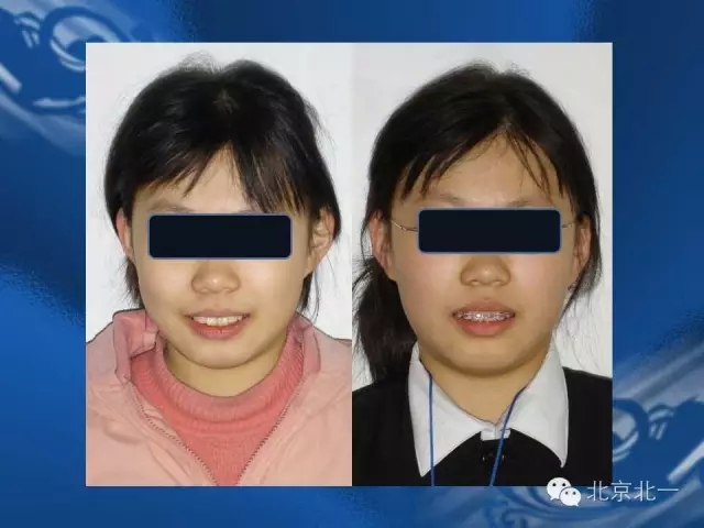 640.webp (5).jpg 640.webp (5).jpg