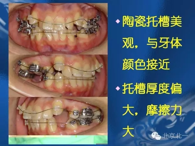 640.webp (7).jpg 640.webp (7).jpg