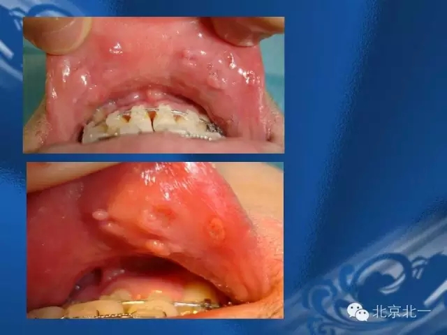 640.webp (8).jpg 640.webp (8).jpg