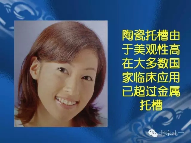 640.webp (10).jpg 640.webp (10).jpg