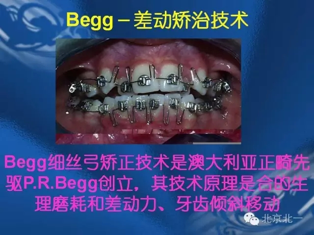 640.webp (22).jpg 640.webp (22).jpg