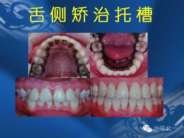 640.webp (28).jpg 640.webp (28).jpg