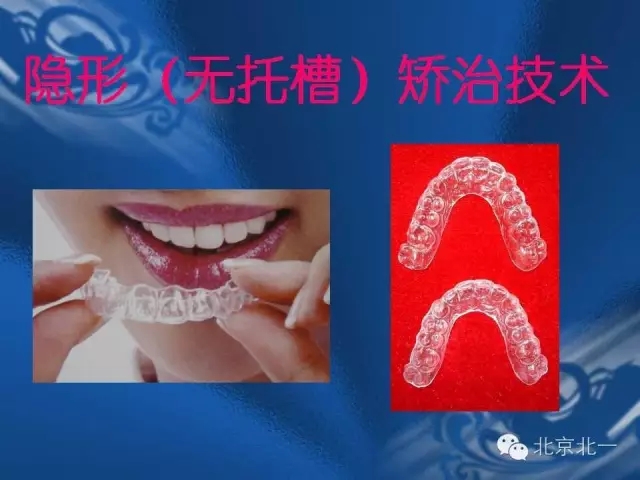 640.webp (29).jpg 640.webp (29).jpg