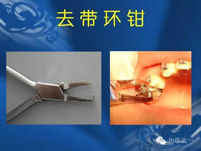 640.webp (38).jpg 640.webp (38).jpg