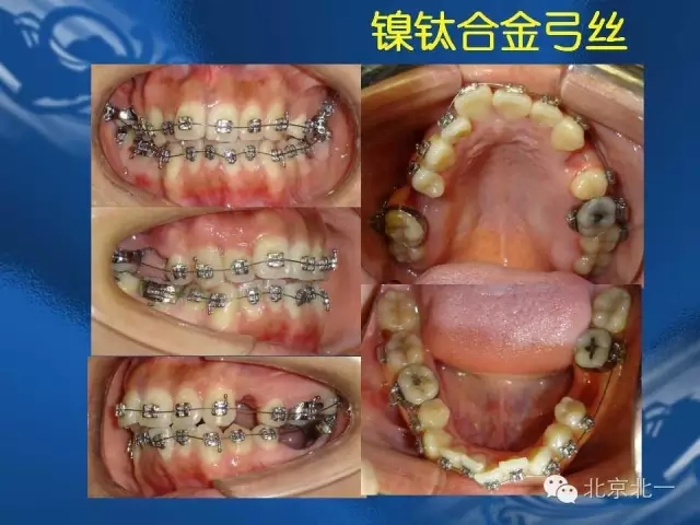 640.webp (42).jpg 640.webp (42).jpg