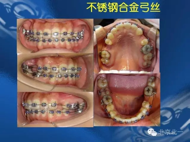 640.webp (45).jpg 640.webp (45).jpg