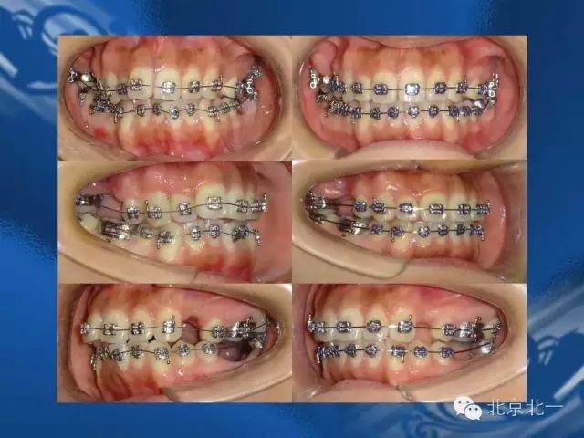 640.webp (46).jpg 640.webp (46).jpg