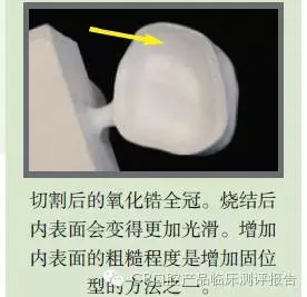 CR權(quán)威發(fā)布:如何克服氧化鋯粘固時的問題 CR權(quán)威發(fā)布:如何克服氧化鋯粘固時的問題