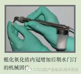 CR權(quán)威發(fā)布:如何克服氧化鋯粘固時的問題 CR權(quán)威發(fā)布:如何克服氧化鋯粘固時的問題