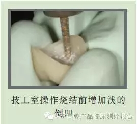 CR權(quán)威發(fā)布:如何克服氧化鋯粘固時的問題 CR權(quán)威發(fā)布:如何克服氧化鋯粘固時的問題