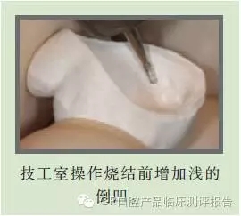 CR權(quán)威發(fā)布:如何克服氧化鋯粘固時的問題 CR權(quán)威發(fā)布:如何克服氧化鋯粘固時的問題