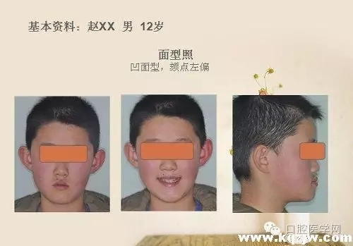 640.webp.jpg 640.webp.jpg