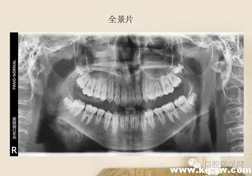 640.webp (2).jpg 640.webp (2).jpg