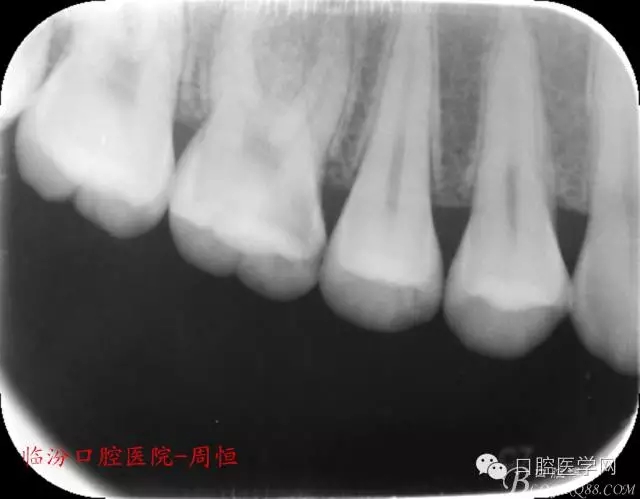 640.webp.jpg 640.webp.jpg