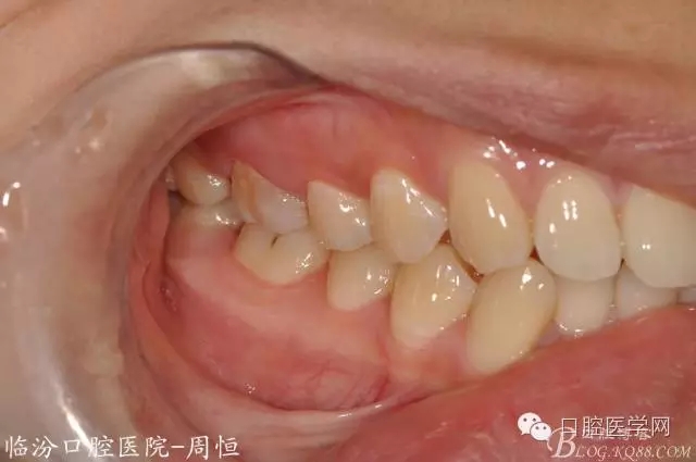 640.webp (3).jpg 640.webp (3).jpg