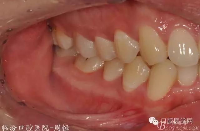 640.webp (12).jpg 640.webp (12).jpg