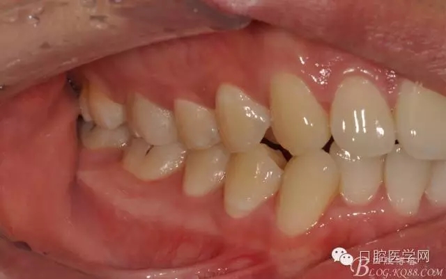 640.webp (13).jpg 640.webp (13).jpg