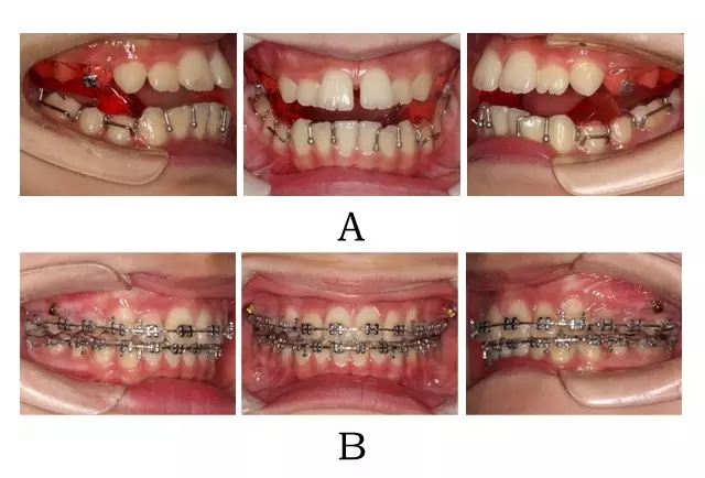 640.webp (2).jpg 640.webp (2).jpg