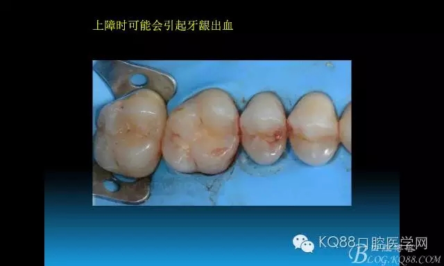 640.webp (33).jpg 640.webp (33).jpg