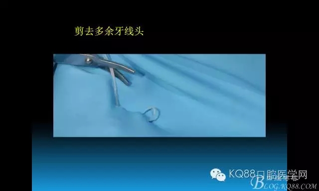 640.webp (69).jpg 640.webp (69).jpg