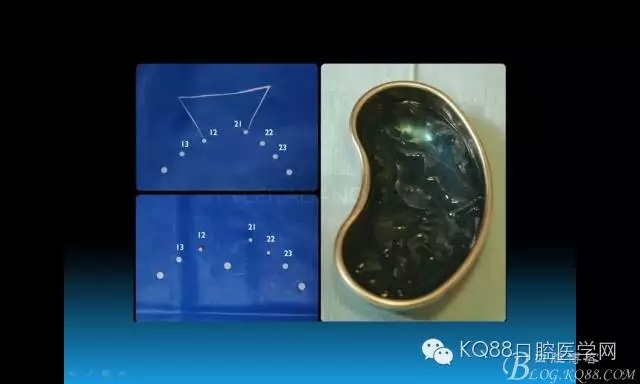 640.webp (76).jpg 640.webp (76).jpg