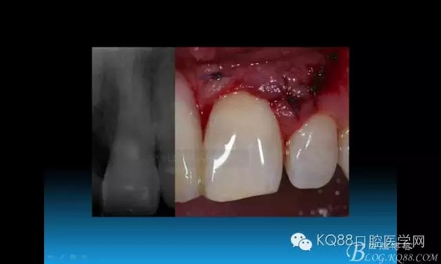 640.webp (79).jpg 640.webp (79).jpg