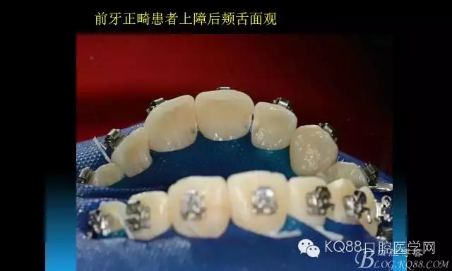 640.webp (89).jpg 640.webp (89).jpg