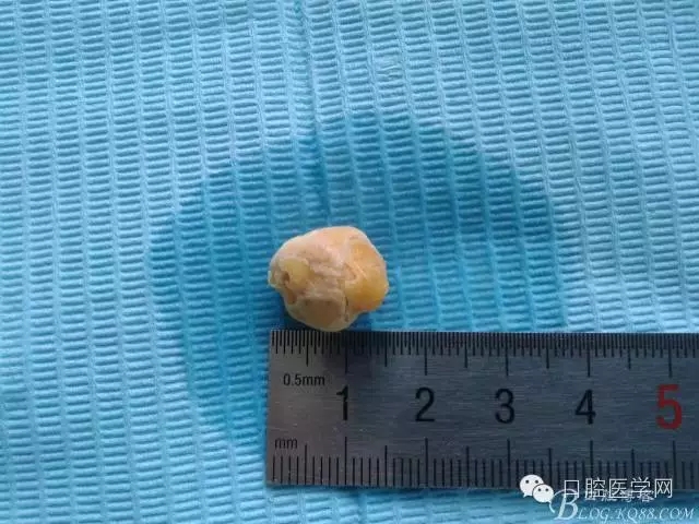 640.webp (1).jpg 640.webp (1).jpg