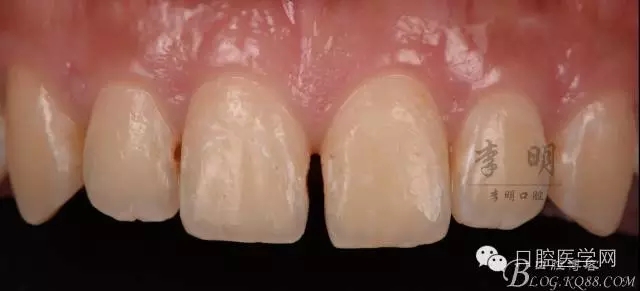 640.webp.jpg 640.webp.jpg