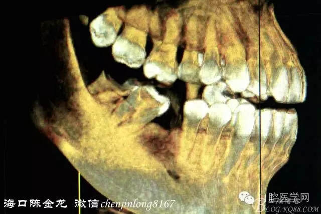 640.webp (1).jpg 640.webp (1).jpg