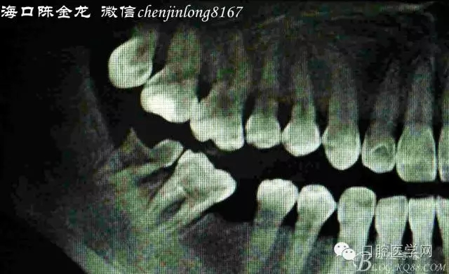 640.webp (2).jpg 640.webp (2).jpg