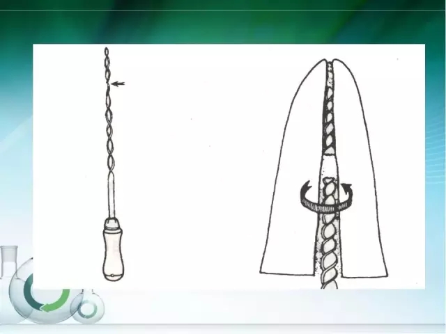 根管治療并發(fā)癥及處理 根管治療并發(fā)癥及處理