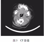 640.webp (6).jpg 640.webp (6).jpg