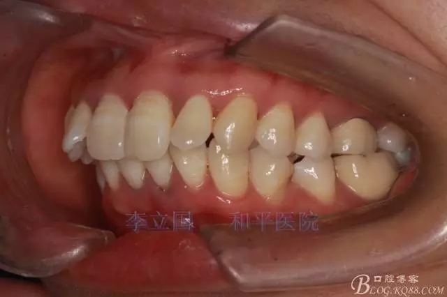 640.webp (2).jpg 640.webp (2).jpg