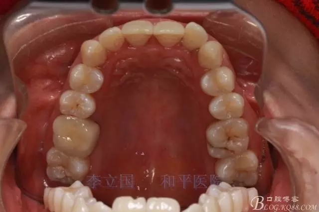 640.webp (3).jpg 640.webp (3).jpg