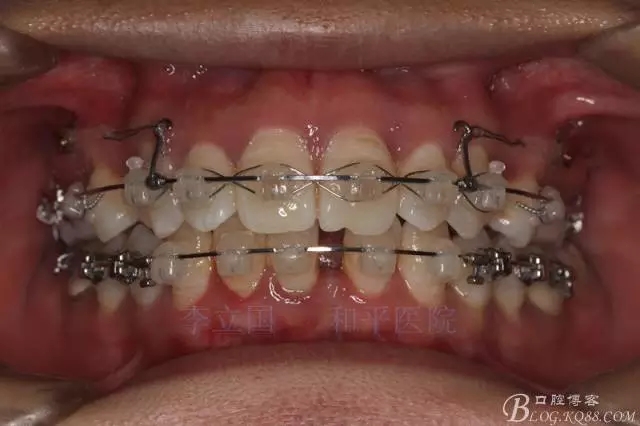 640.webp (5).jpg 640.webp (5).jpg