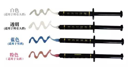 西爾歐窩溝封閉劑 西爾歐窩溝封閉劑