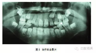 640.webp (2).jpg 640.webp (2).jpg