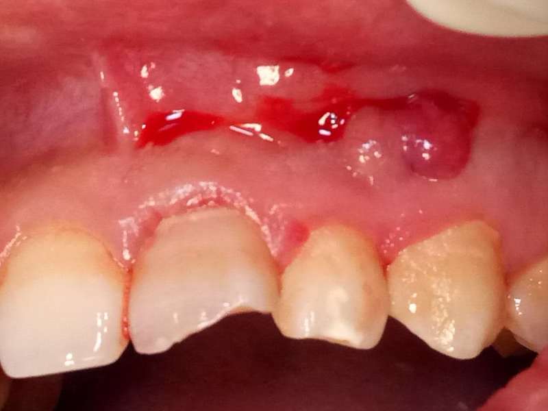 webwxgetmsgimg (1).jpg webwxgetmsgimg (1).jpg