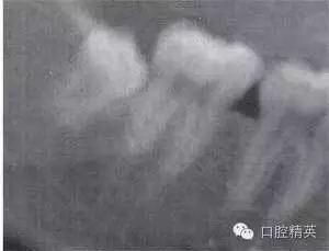 640.webp (11).jpg 640.webp (11).jpg