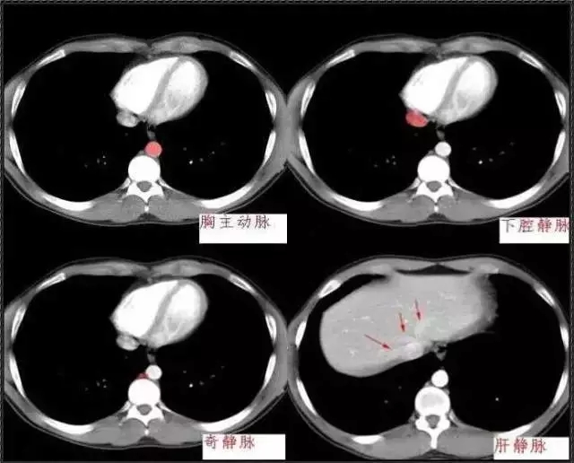 640.webp.jpg 640.webp.jpg