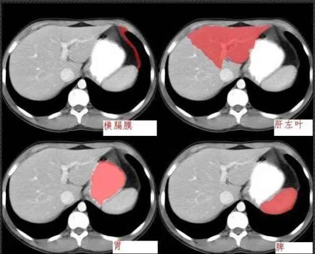 640.webp (2).jpg 640.webp (2).jpg